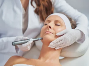 Is Microneedling Good for Your Face?