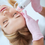 Is Microneedling Once a Week Too Much?