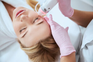 Is Microneedling Once a Week Too Much?