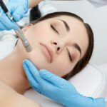 Should I Put Anything on My Face After Microneedling?