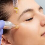 The Best Time of Year To Do Microneedling