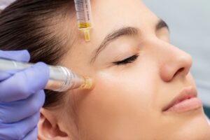 The Best Time of Year To Do Microneedling
