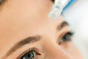 What Are The Do's And Don'ts After Microneedling?