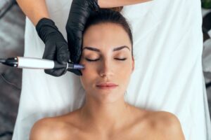 What are the Pros and Cons of Microneedling?