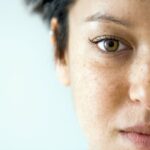 What Do Sunspots on the Face Look Like?