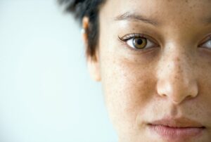 What Do Sunspots on the Face Look Like?
