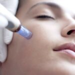 What Does a Microneedling Facial Do?