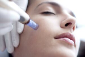 What Does a Microneedling Facial Do?