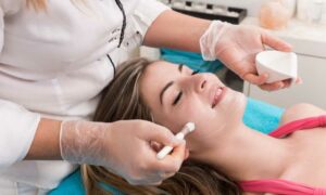 What is the Best Chemical Peel for First Time Users?