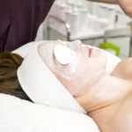 What is the Best Moisturizer After a Chemical Peel?