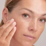 What Is the Difference Between Age Spots and Sunspots?