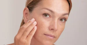 What Is the Difference Between Age Spots and Sunspots?