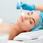 What is the Downside of Chemical Peels?