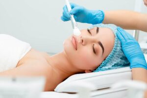 What is the Downside of Chemical Peels?