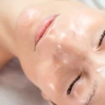 What is the Downtime for a Chemical Peel?