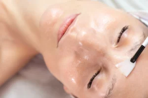 What is the Downtime for a Chemical Peel?