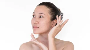 What Is the Main Cause of Age Spots?