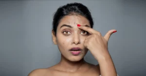 What Is the Main Cause of Dark Spots on Face?