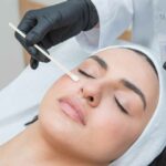 What Not to Put on Your Face After a Chemical Peel?