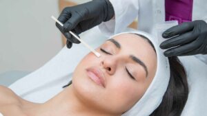 What Not to Put on Your Face After a Chemical Peel?