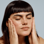 What Vitamin Deficiency Causes Dark Spots on Face?