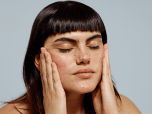 What Vitamin Deficiency Causes Dark Spots on Face?