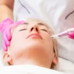 What Vitamins Should I Avoid After Microneedling?