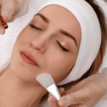 When Can I Wash My Face After a Chemical Peel?