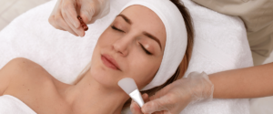 When Can I Wash My Face After a Chemical Peel?