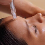When Does Collagen Peak After Microneedling?