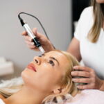 Where is Microneedling Most Effective?