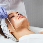 Who is Not a Good Candidate for a Chemical Peel?
