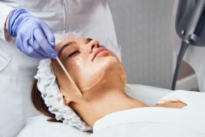 Who is Not a Good Candidate for a Chemical Peel?