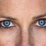 Why Do Age Spots Suddenly Appear?