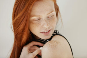 Why Do I Get Sunspots Even with Sunscreen?