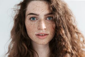 Why Do I Suddenly Have Sunspots on My Face?
