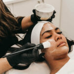 Why Is My Skin Not Peeling After a Chemical Peel?