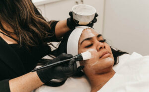 Why Is My Skin Not Peeling After a Chemical Peel?