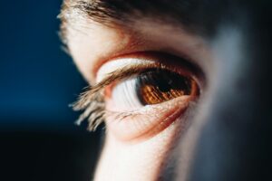 Why am I suddenly allergic to eye makeup?