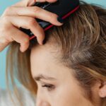 Why is My Hair So Thin I Can See My Scalp?