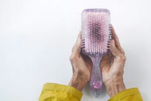 Does Oily Hair Mean Hair Loss?