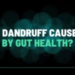 Is Dandruff Caused By Gut Health?