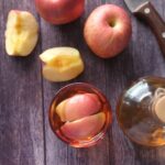 How Often Should I Use Apple Cider Vinegar on My Hair For Dandruff?