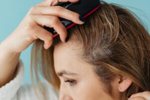 Should You Brush Dandruff Off Your Scalp?