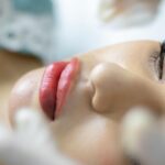How Can I Plump My Lips Without Fillers?