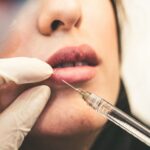 What Is a Permanent Lip Plumper?