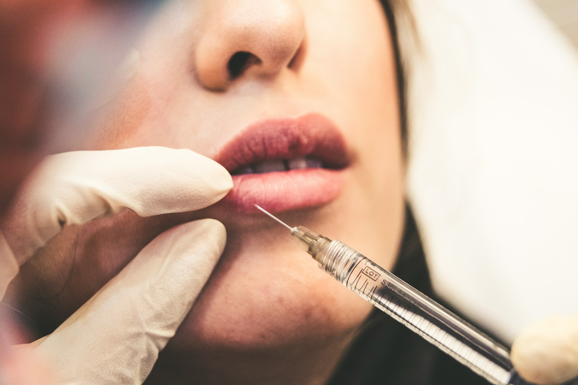 What Is a Permanent Lip Plumper?