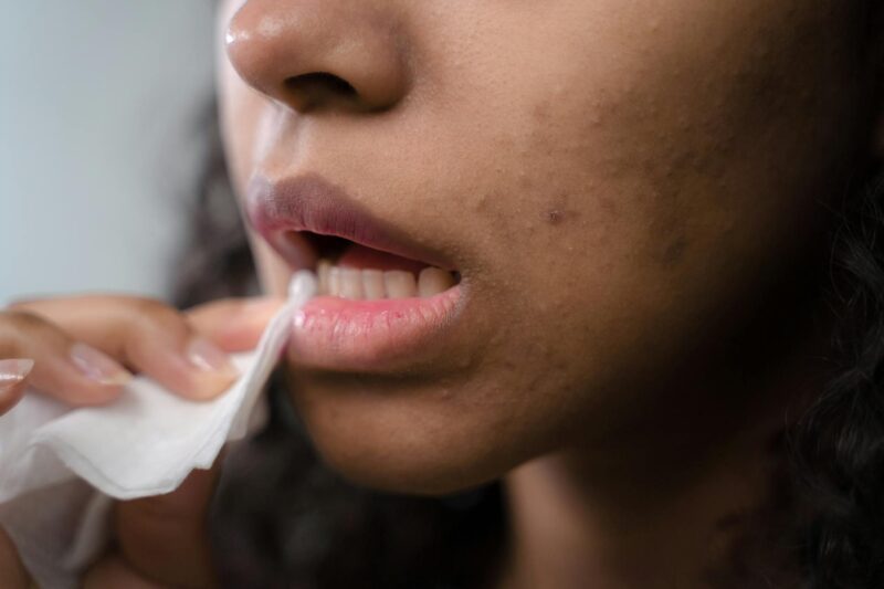How Do You Take a Lip Stain Off?